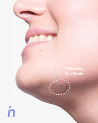 Hydrocolloid Patches with Microcapsules for Blind Pimples - My Way Out