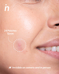Invisible Hydrocolloid Patches for Pimples - Spot Me Here