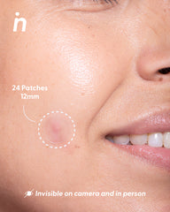 Invisible Hydrocolloid Patches for Pimples - Spot Me Here x2