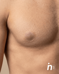 His & Hers Nipple Cover Set: Anti - Chafe (Him) + Adhesive - Free (Her) - Nipskin - Nipskin Stickwear™