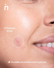 Invisible Hydrocolloid Patches for Pimples - Spot Me Here - Nipskin Stickwear™