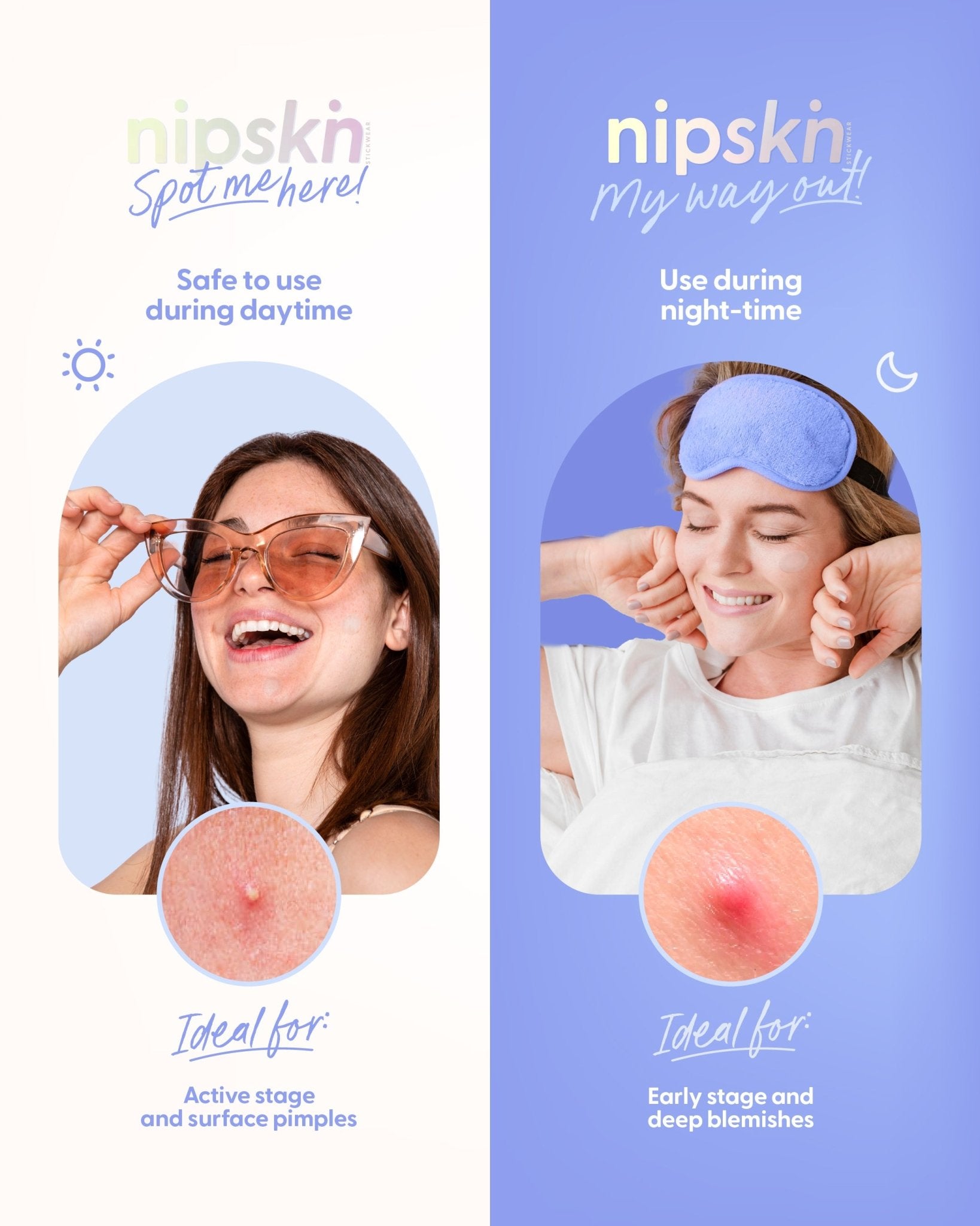 Own Your Spot Kit - Nipskin Stickwear™