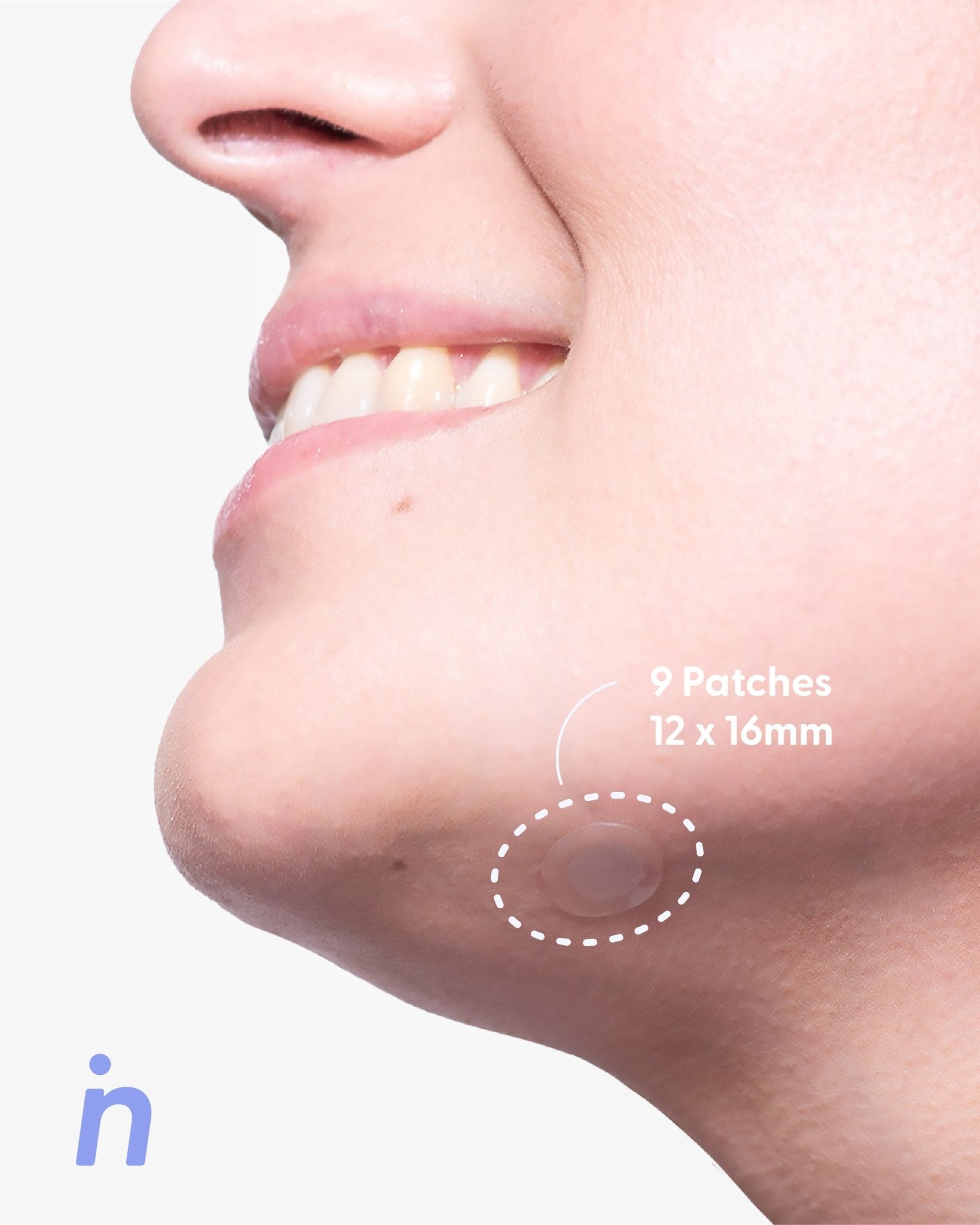 Patch You Later Kit - Nipskin Stickwear™